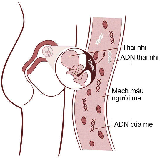  Xét nghiệm sàng lọc trước sinh không xâm lấn (NIPT)